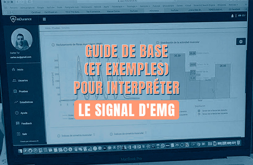Guide de base pour interpréter le signal d'EMG