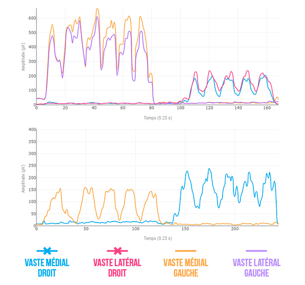 acheter une électromyographe
