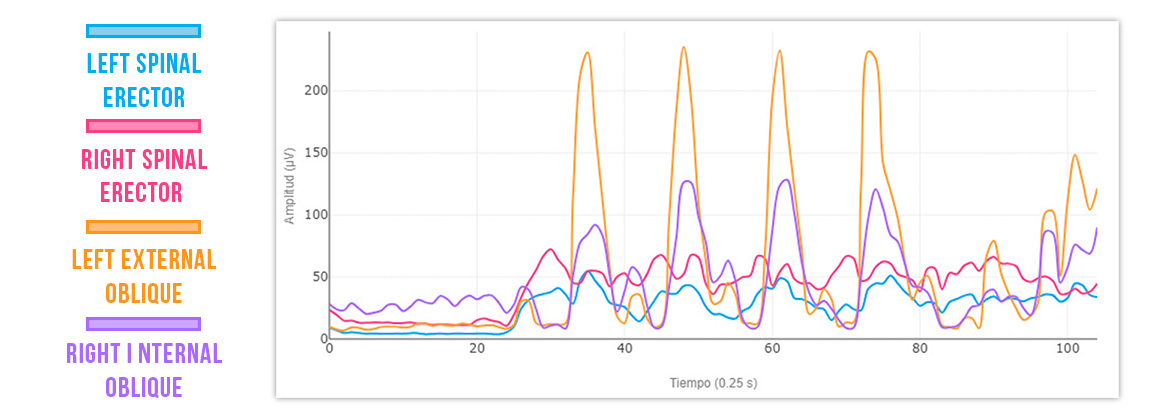 Lateral Trunk Rotation
