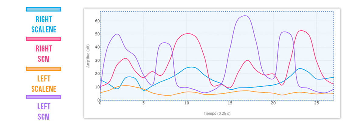 limited cervical rotation