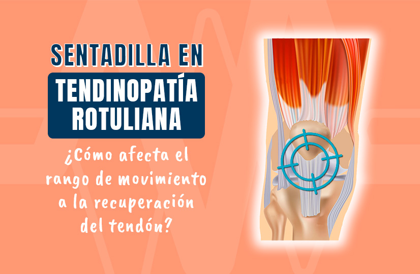 Sentadilla en tendinopatía rotuliana