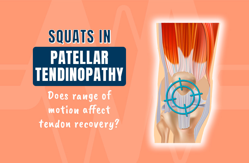 Squats in Patellar Tendinopathy