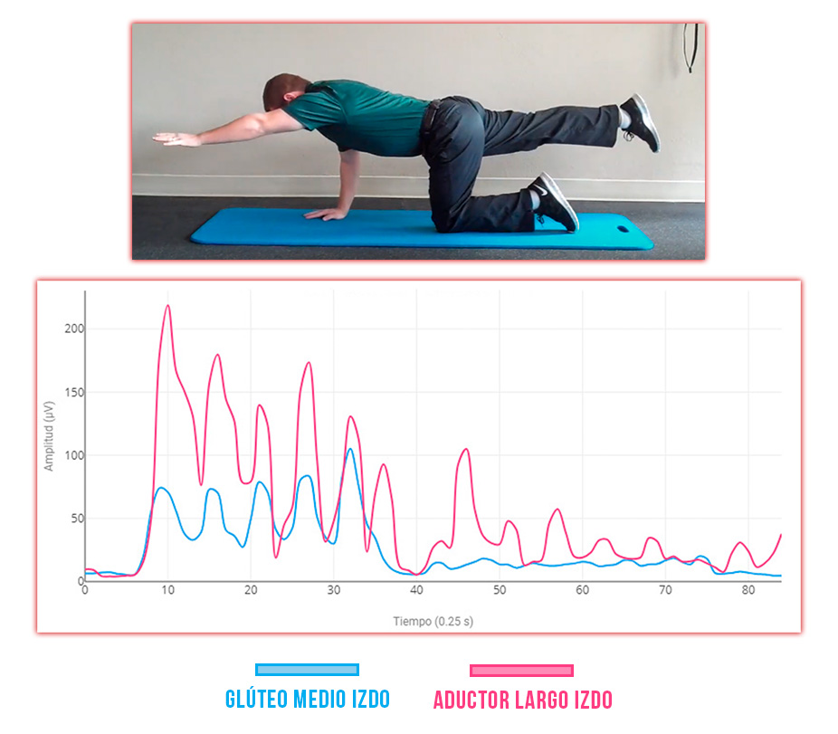 sinergia glúteo medio - aductor largo