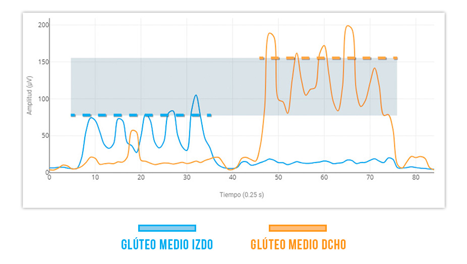 sinergia glúteo medio - aductor largo