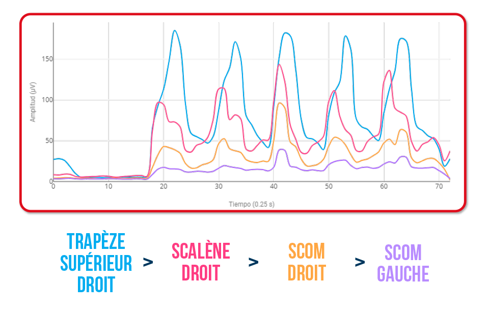 flexion latérale cervicale