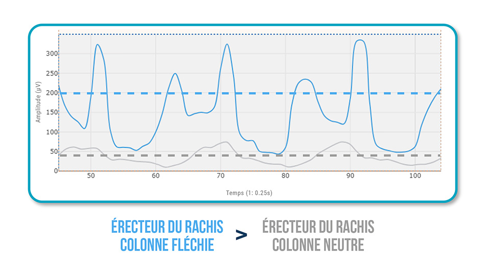 Synergie Fessier - Lombaires