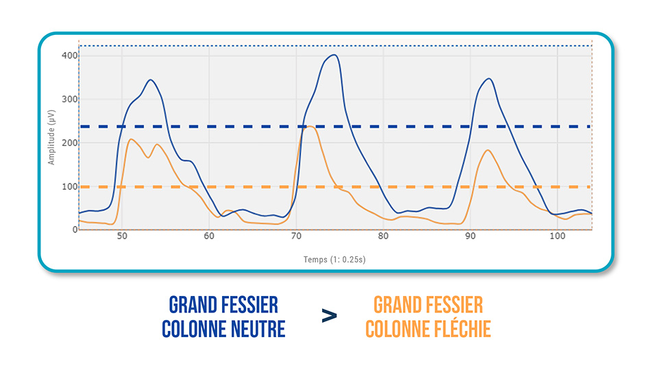 Synergie Fessier - Lombaires