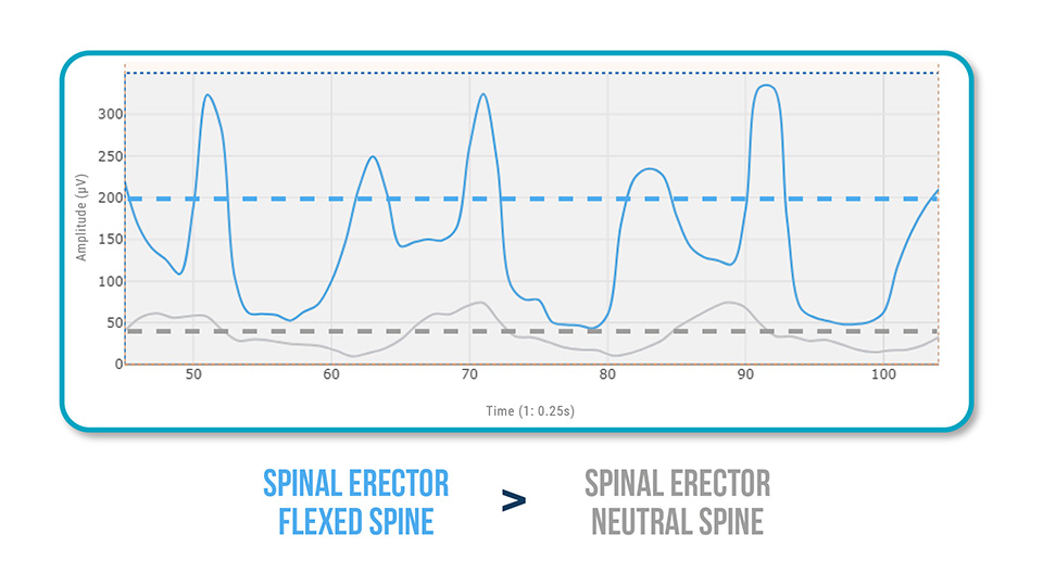 Glute-Lumbar Synergy