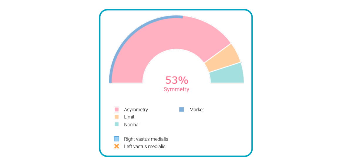 surface electromyography