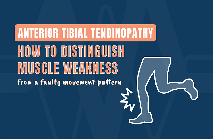 Anterior Tibial Tendinopathy