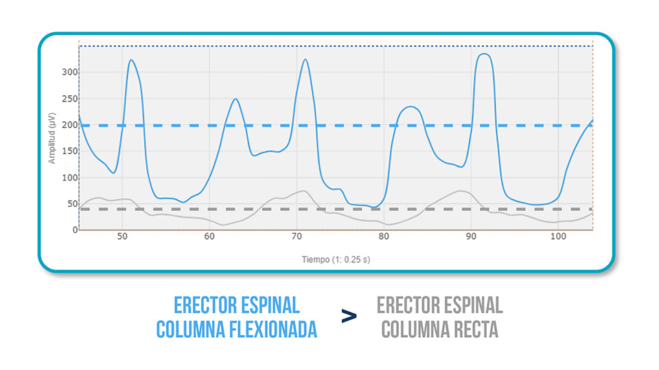 Sinergia Glúteo - Lumbar