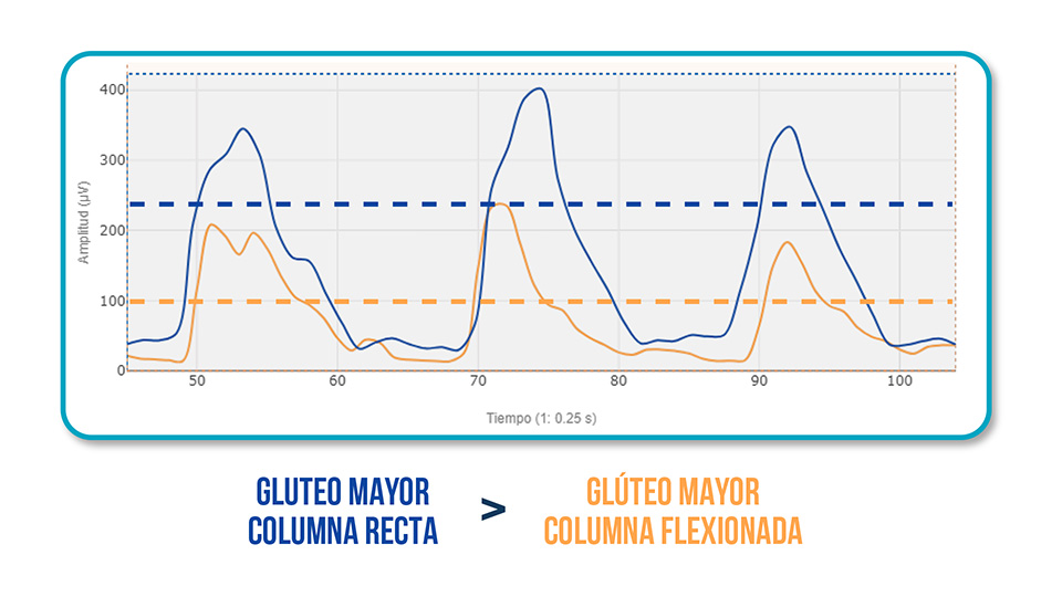 Sinergia Glúteo - Lumbar