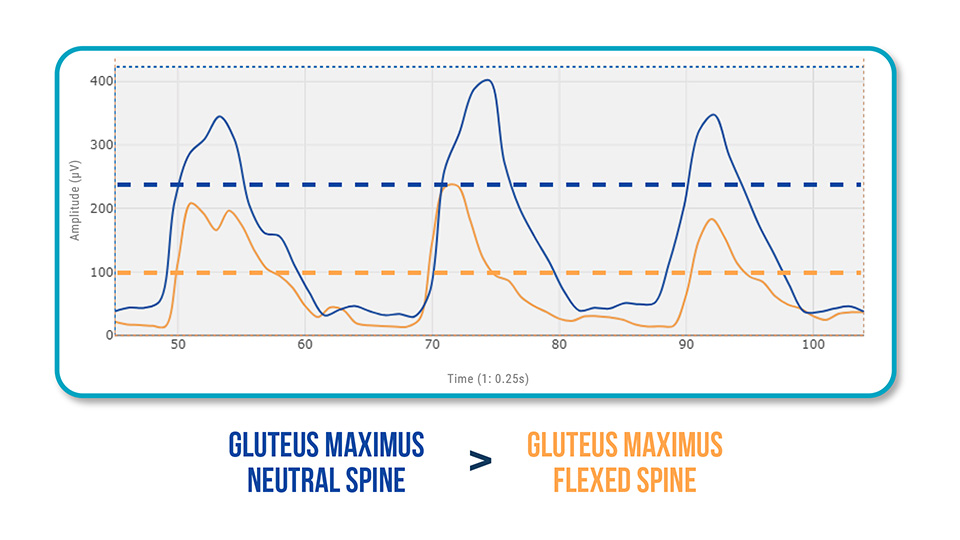 Glute-Lumbar Synergy