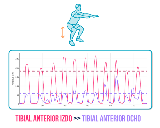 Tendinopatía del Tibial anterior