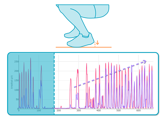 Anterior Tibial Tendinopathy