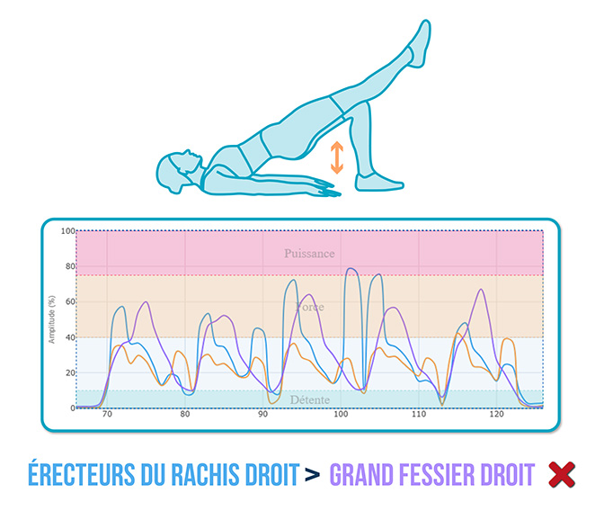 activación del glúteo mayor