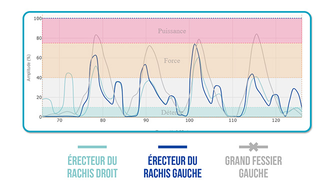 activación del glúteo mayor