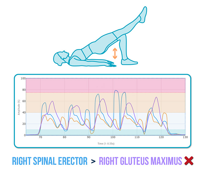 Gluteus Maximus Activation