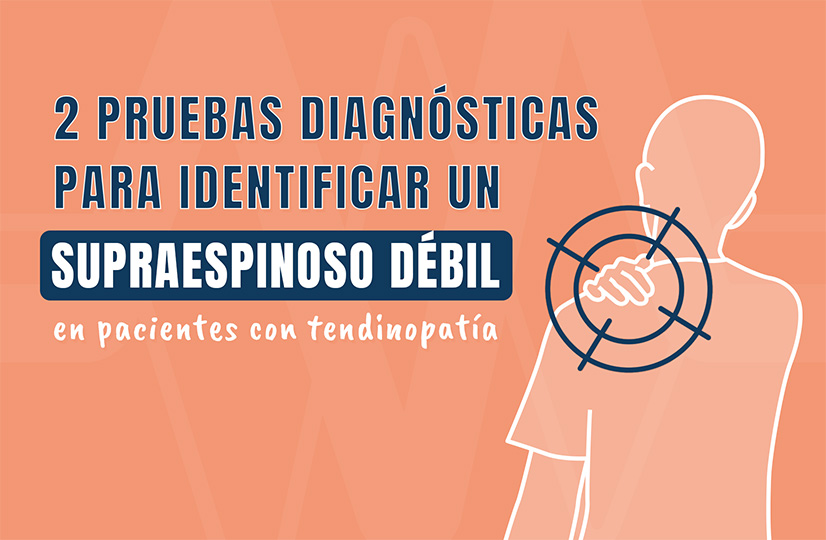 Dos pruebas diagnósticas para identificar un supraespinoso débil en pacientes con tendinopatía