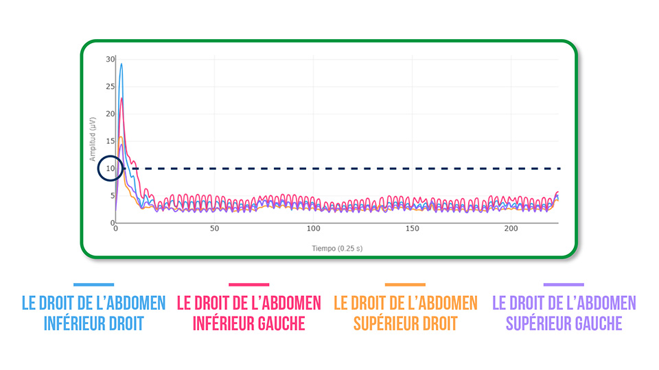 transverse de l’abdomen