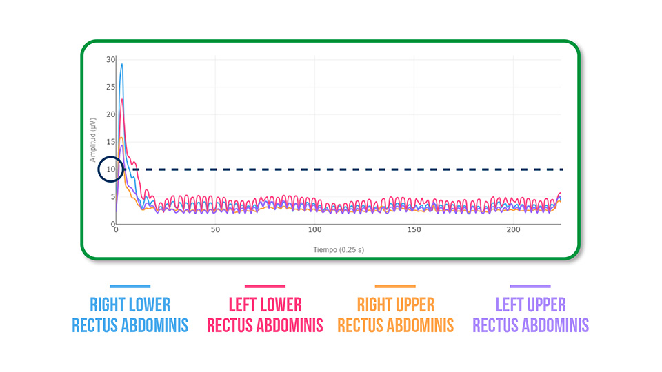 Transverse Abdominis