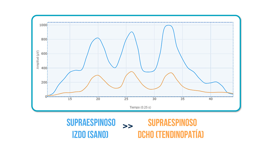 pacientes con tendinopatía