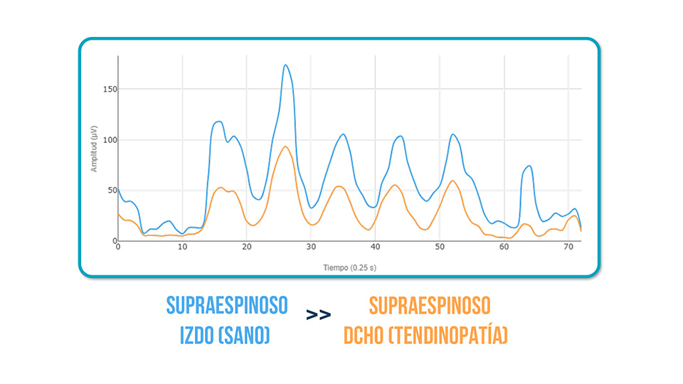 pacientes con tendinopatía