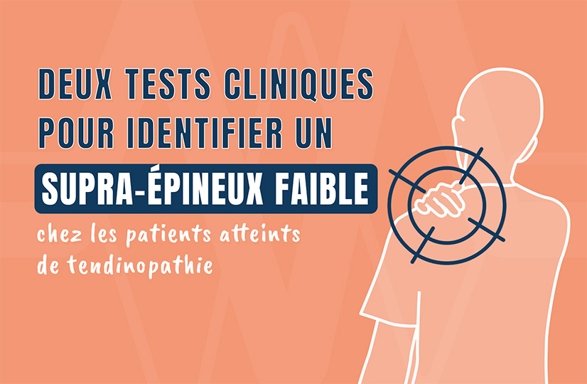 Deux tests cliniques pour identifier un supra-épineux faible chez les patients atteints de tendinopathie