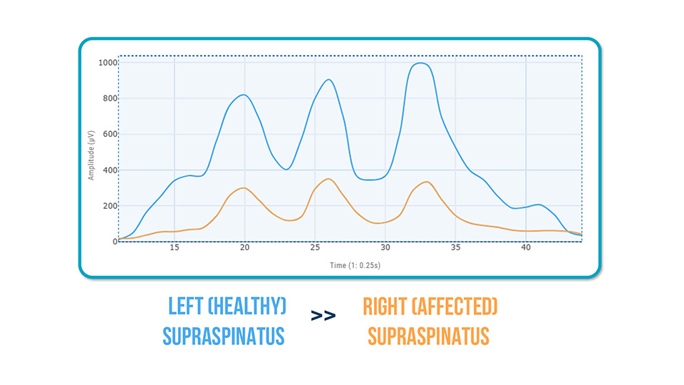 Patients with Tendinopathy