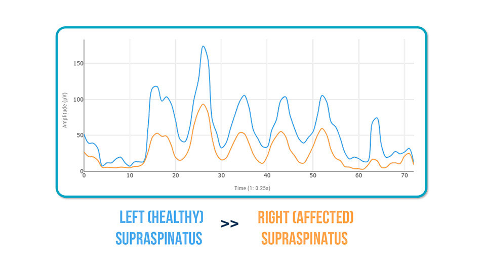 Patients with Tendinopathy