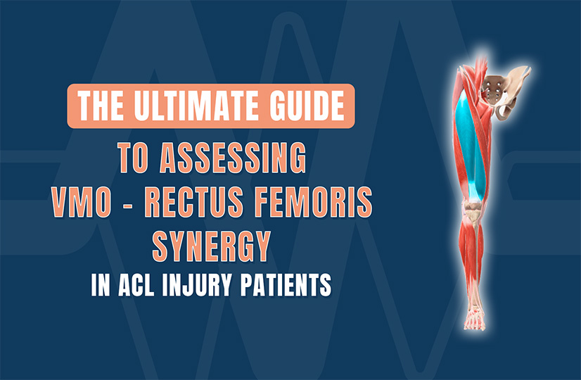 The Ultimate Guide to Assessing VMO–Rectus Femoris Synergy in ACL Injury Patients