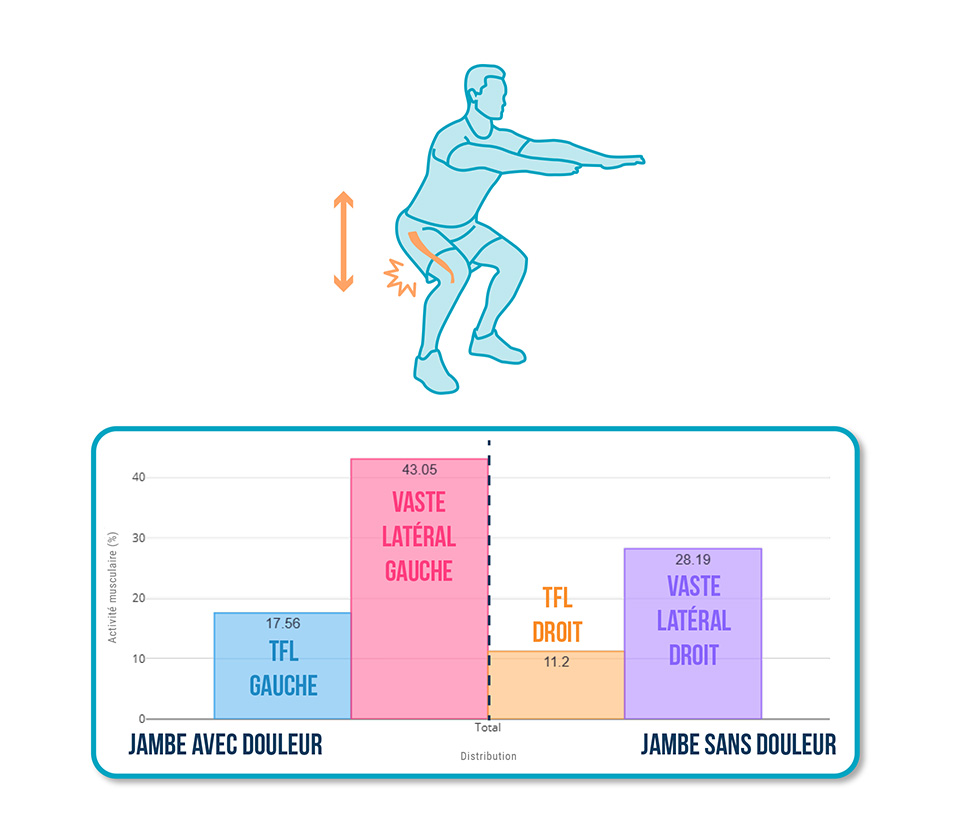 bandelette ilio-tibiale