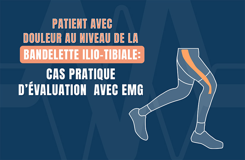 bandelette ilio-tibiale