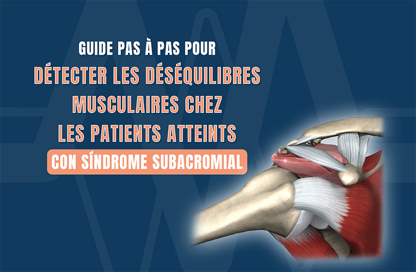 syndrome subacromial