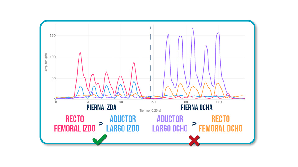 Sinergia Recto Femoral