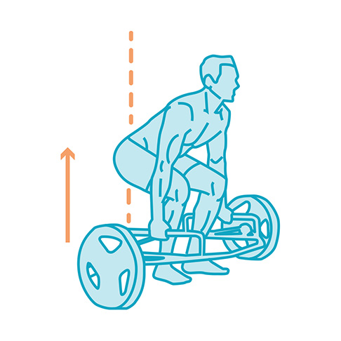 gluteus maximus hypertrophy