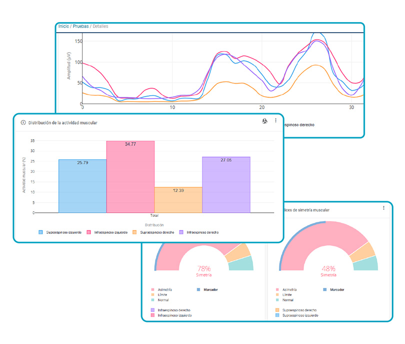 Électromyographie de surface