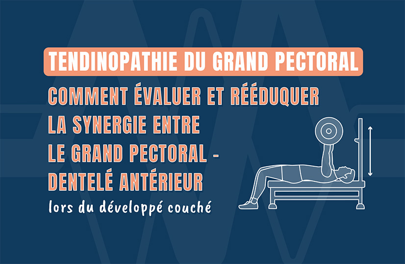 Tendinopathie du grand pectoral
