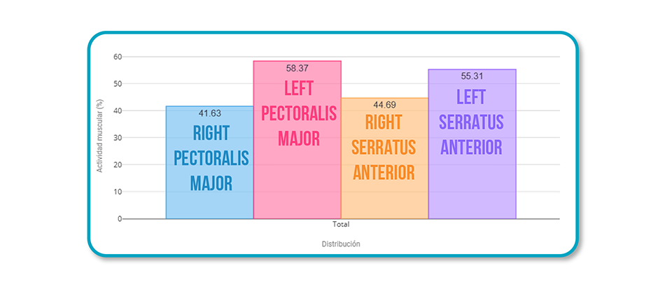 Pectoralis Major Tendinopathy