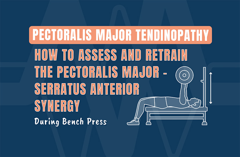 Pectoralis Major Tendinopathy