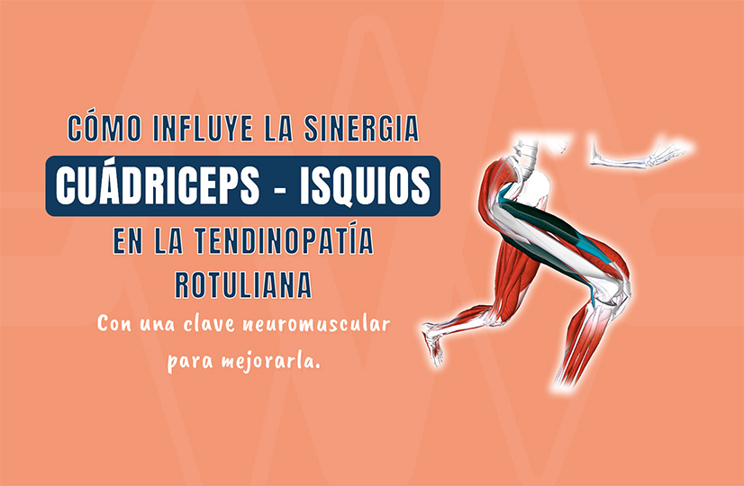 Cómo influye la sinergia cuádriceps–isquios en la tendinopatía rotuliana