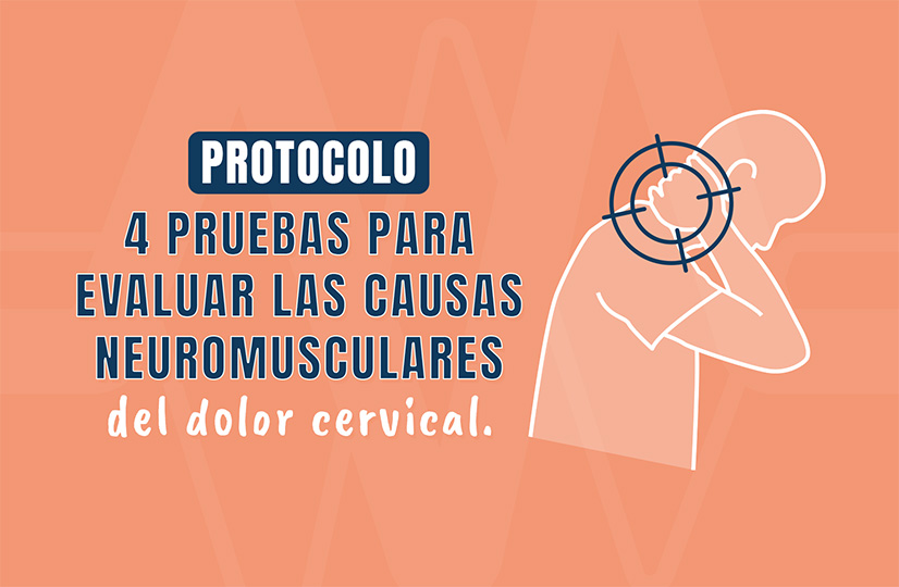 Protocolo de 4 pruebas para evaluar las causas neuromusculares del dolor cervical